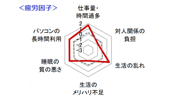 Retina 1